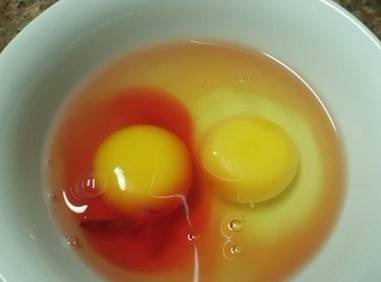 血雞蛋