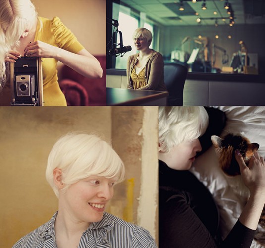 albinism_mini